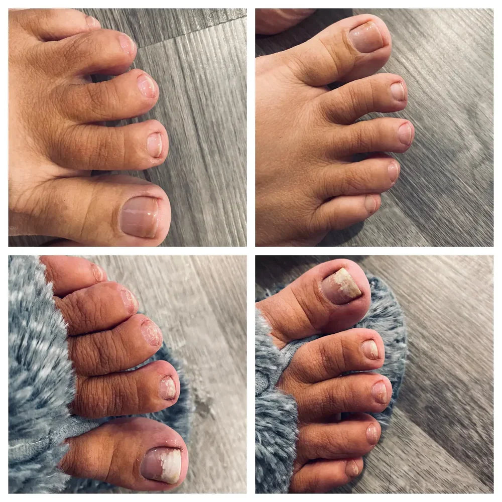 Swisscure™ - Your Path to Healthier-Looking Nails .