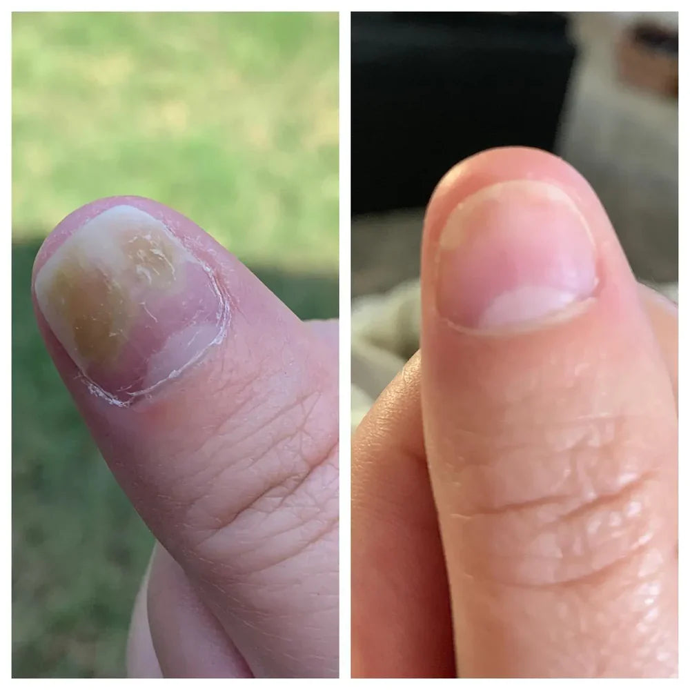 Swisscure™ - Your Path to Healthier-Looking Nails .