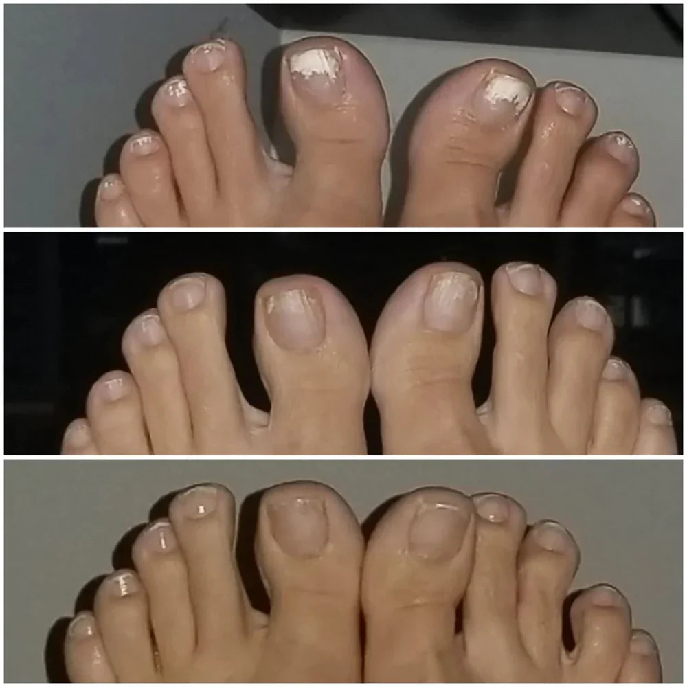 Swisscure™ - Your Path to Healthier-Looking Nails .