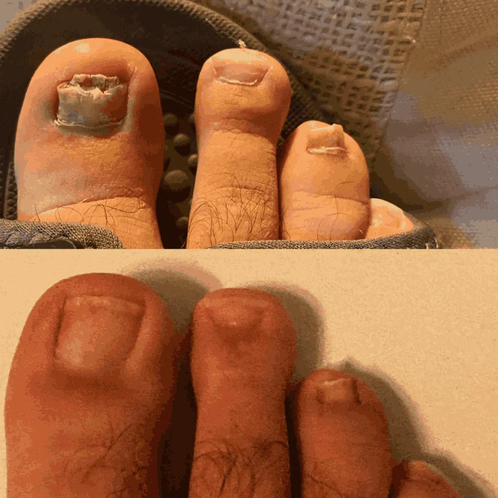 Swisscure™ - Your Path to Healthier-Looking Nails