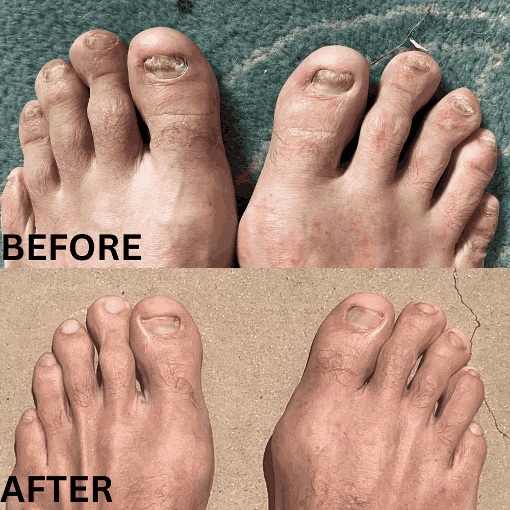 Swisscure™ - Your Path to Healthier-Looking Nails .